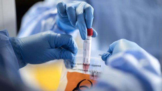 Paciente recuperado del SARS de 2003 desarrolló anticuerpo capaz de inhibir el nuevo coronavirus