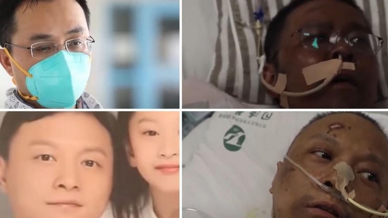 Murió uno de los médicos chinos con Covid-19 cuya piel se ennegreció