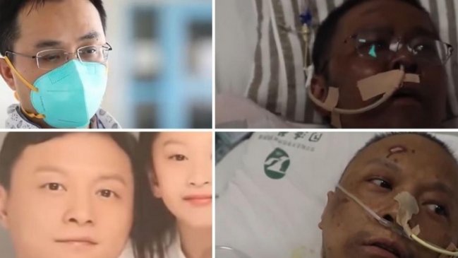 Murió uno de los médicos chinos con Covid-19 cuya piel se ennegreció