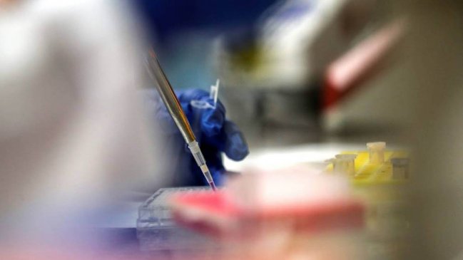 Estudio detecta diferencias en sangre de pacientes graves y leves de Covid