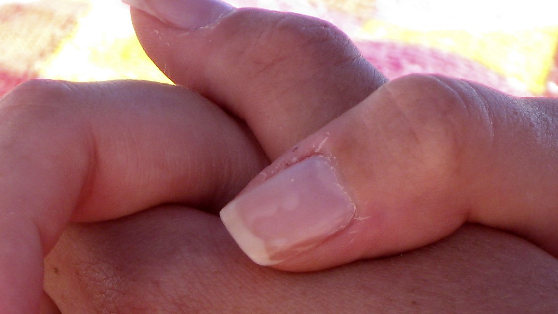 Mujer embarazada fue atacada a mordidas y golpes de martillo por su marido