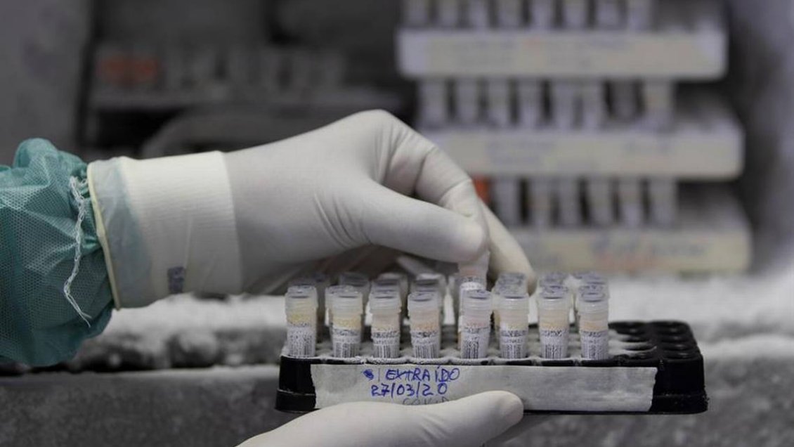 Estudio británico revela que esteroide de bajo costo puede salvar vidas de pacientes graves de Covid-19