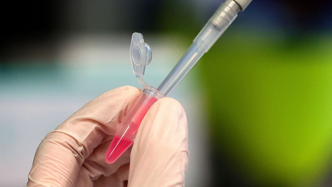 Oxford ya produce vacunas para distribuirlas en diciembre una vez testeadas