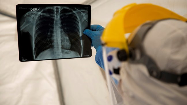 Perú supera los 260.000 casos de Covid-19 al cumplir 100 días de cuarentena nacional