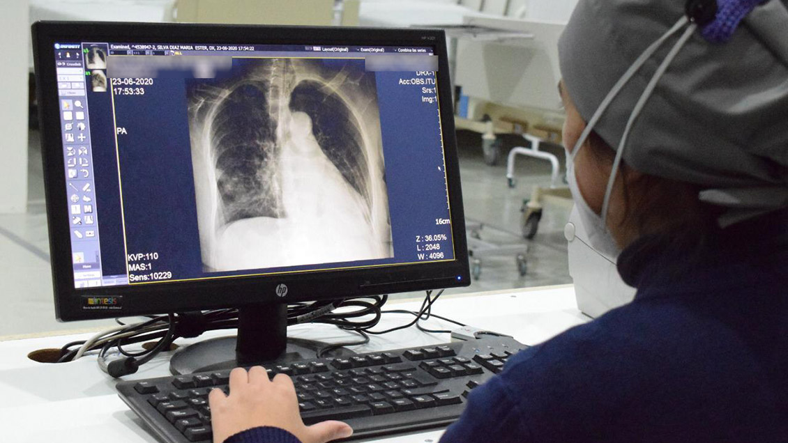 Latinoamérica supera las 100.000 muertes por Covid-19