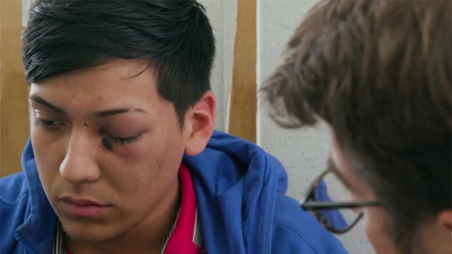 Reportaje sobre daños oculares provocados por balines fue nominado a los Emmy