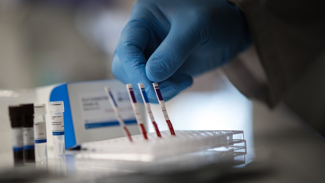 Coronavirus en Chile: Tasa de positividad llega a su nivel más bajo desde abril