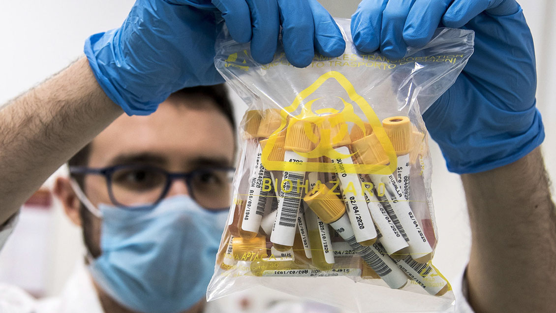 Italia comenzó ensayos en humanos de su vacuna contra el Covid-19