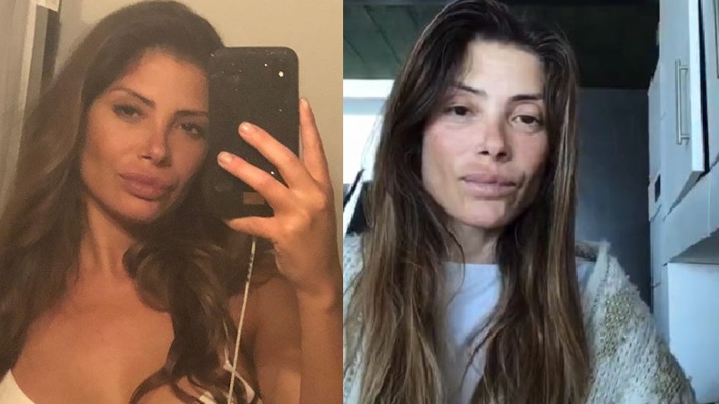 Colegio de Nutricionistas interpuso denuncia contra Roxana Muñoz por prolongado ayuno