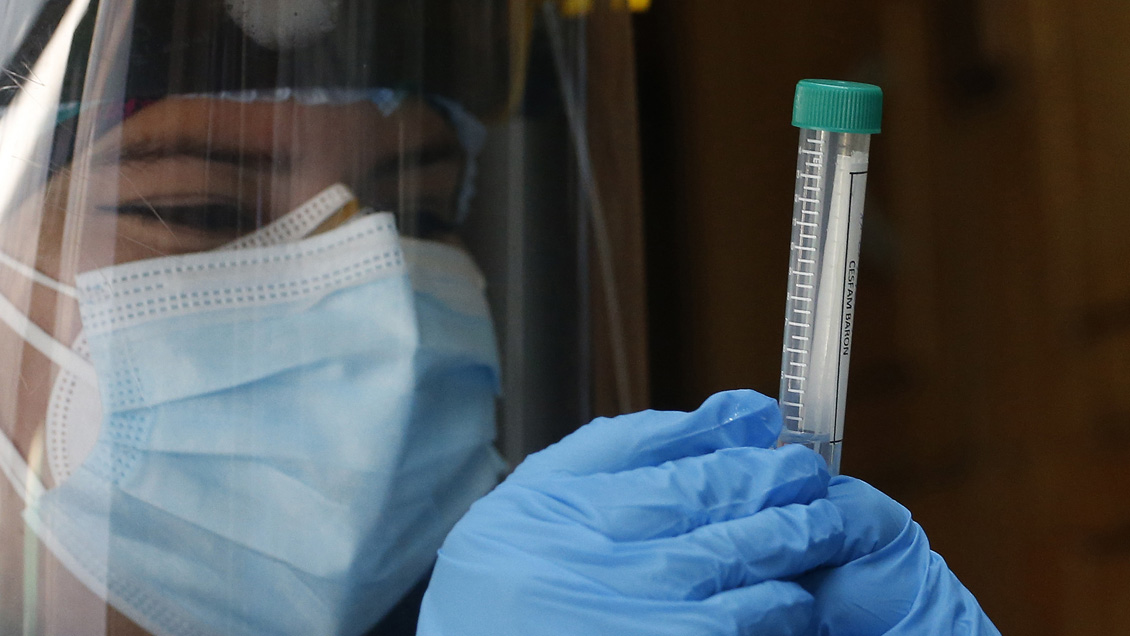 Balance Covid: 1.415 casos nuevos y 32 fallecidos en la última jornada