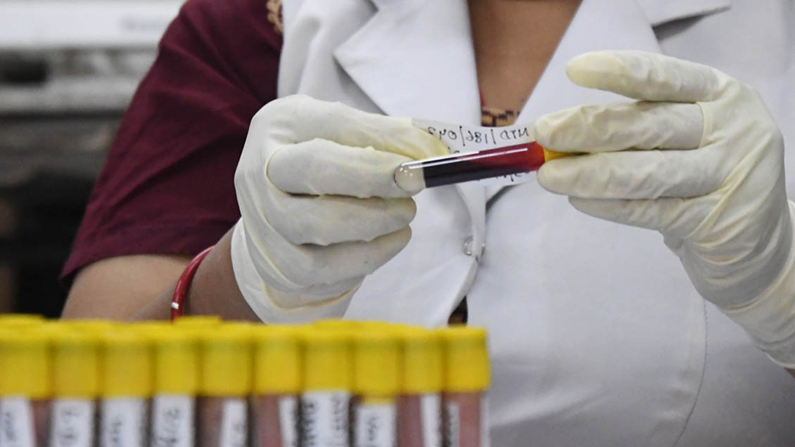 India rompe su propio récord mundial con 83.883 casos diarios de Covid-19