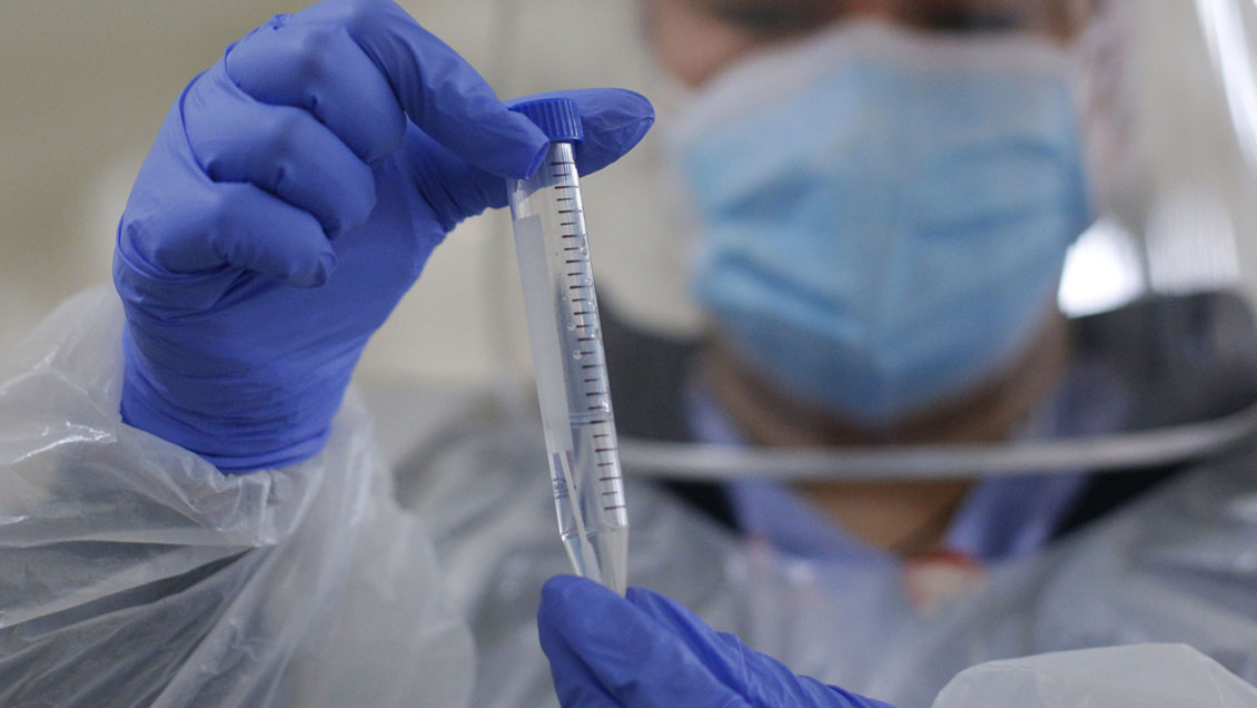 Balance Covid: 1.965 nuevos casos y 72 fallecimientos