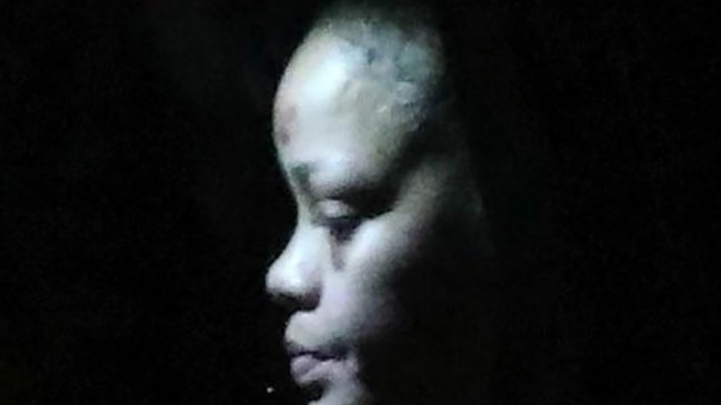 Rihanna quedó con golpes en su cara tras accidente con scooter eléctrico