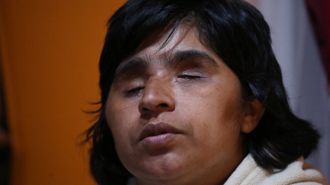 Fabiola Campillai fue hospitalizada por daño craneal: Está a la espera de una cirugía