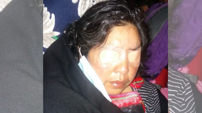Madre de Camilo Catrillanca resultó con ceguera temporal por gas pimienta