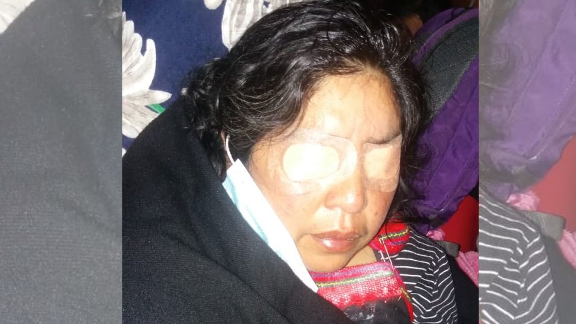 Madre de Camilo Catrillanca resultó con ceguera temporal por gas pimienta