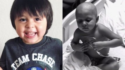   Pequeño de cuatro años superó tratamiento contra leucemia tras 93 quimioterapias 