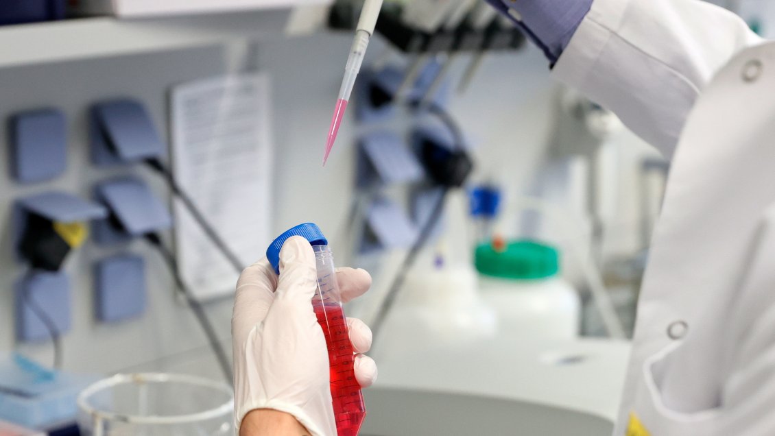 Minsal descartó haber entregado otra cifra de fallecidos por pandemia a la OMS