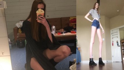 Récord Guinness: Joven tiene las piernas más largas del mundo
