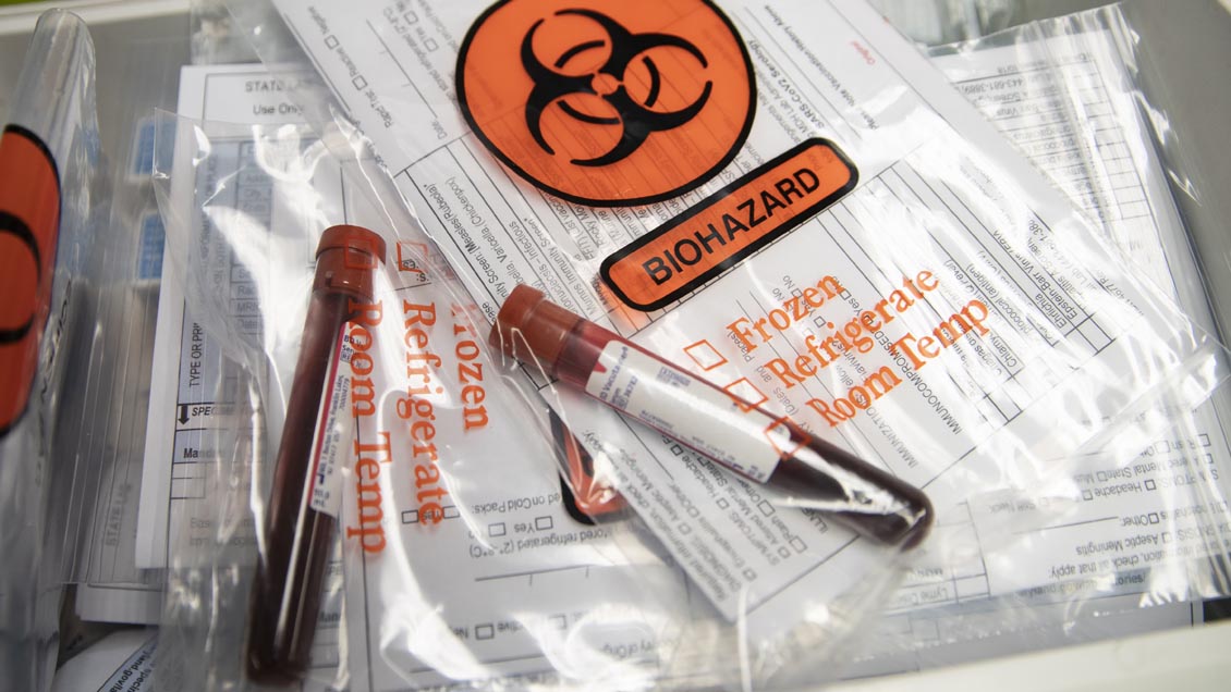 Los casos globales de Covid-19 subieron a 38,3 millones, con 1,08 millones de muertes