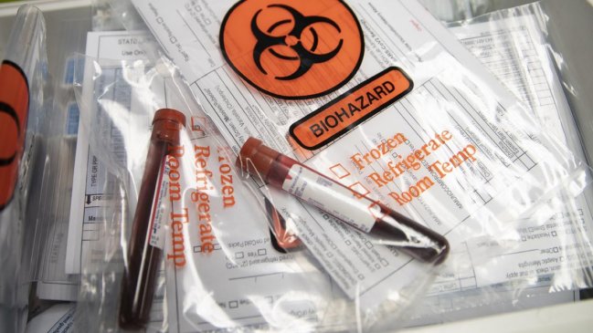 Los casos globales de Covid-19 subieron a 38,3 millones, con 1,08 millones de muertes