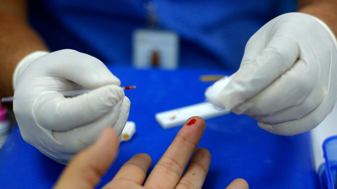 Nuevo caso de reinfección del Covid-19 se registró en Suecia