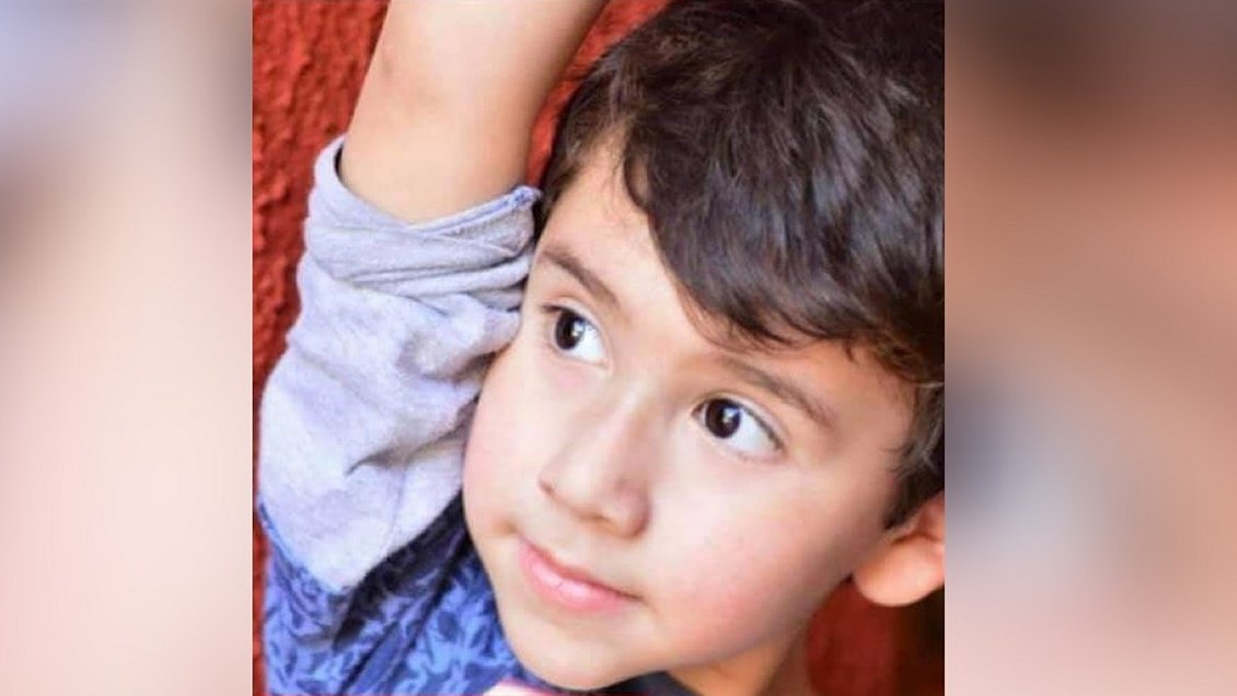 Niño talquino de cinco años necesita 