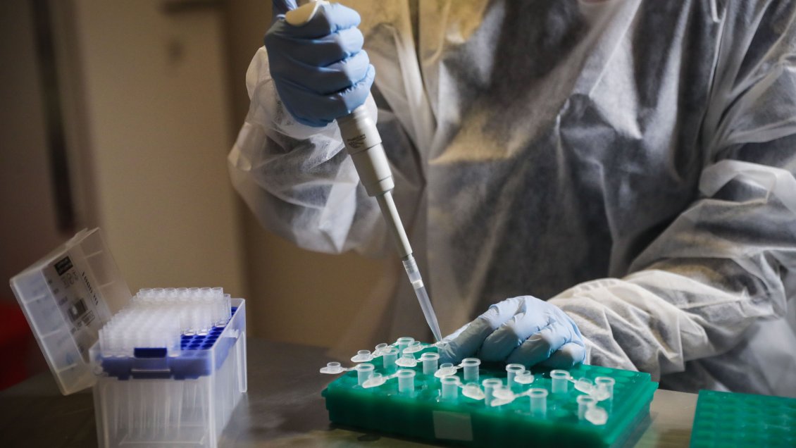 Infectóloga reconoce que logística para traer vacuna Pfizer 