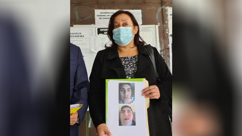 Familia acusa que Carabineros golpeó a joven hasta quebrarle los dientes en Chiguayante