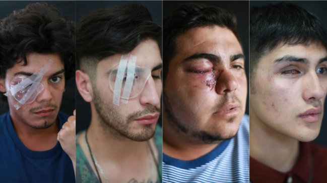 Fotógrafo chileno logra importante reconocimiento internacionalmente por su obra con heridos oculares