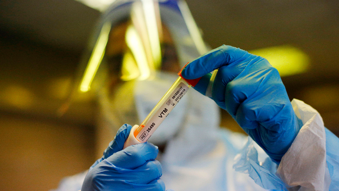 Chile superó los 22 mil casos activos de Covid-19