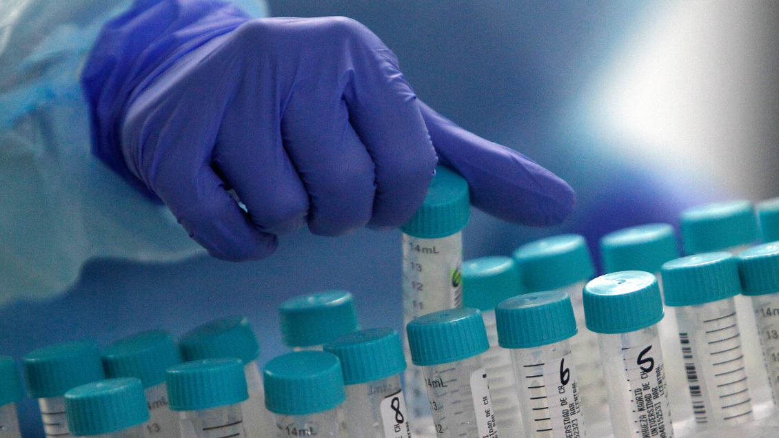 Confirman brote de Covid-19 en municipalidad de Machalí