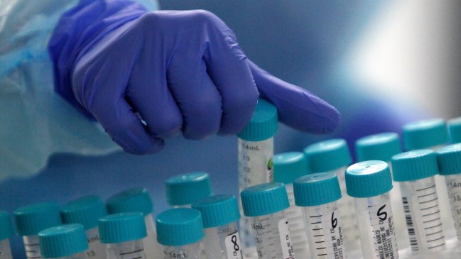 Confirman brote de Covid-19 en municipalidad de Machalí