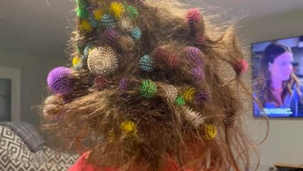   Paciencia nivel experto: Tardó 20 horas en sacar juguetes pegados al pelo de su hija 