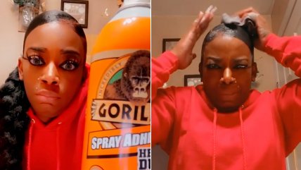   Mujer usó pegamento industrial en vez de laca para el pelo: terminó en el hospital 