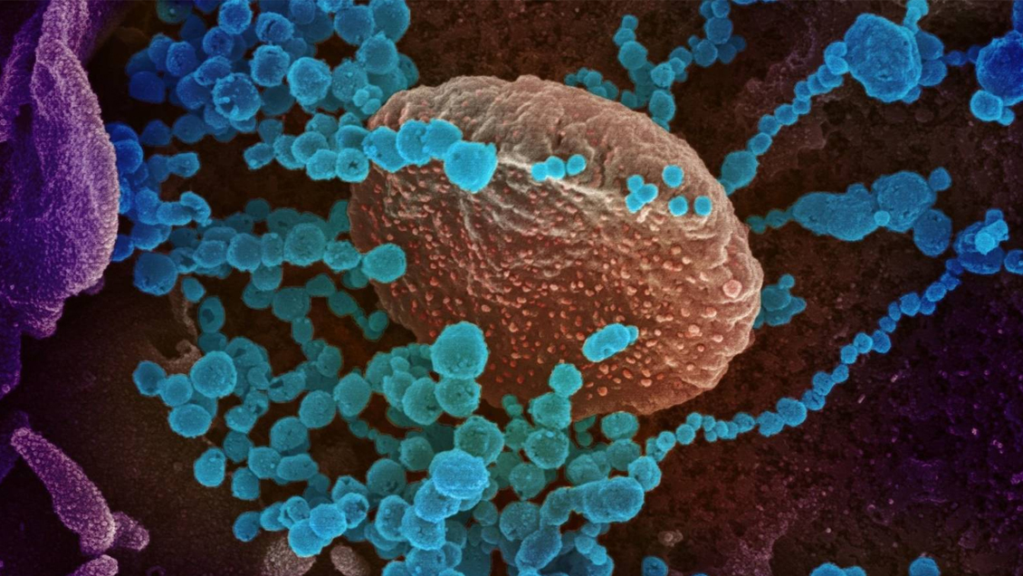 El Covid-19 se originó en una granja de animales exóticos al sur de China, según investigador de la OMS