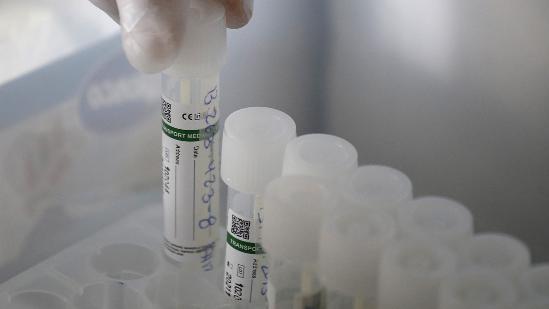 Informe Epidemiológico: Casos activos actuales de Covid son casi un tercio que hace un mes