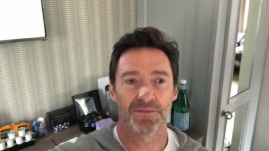 Hugh Jackman asegura que el resultado de su biopsia fue 