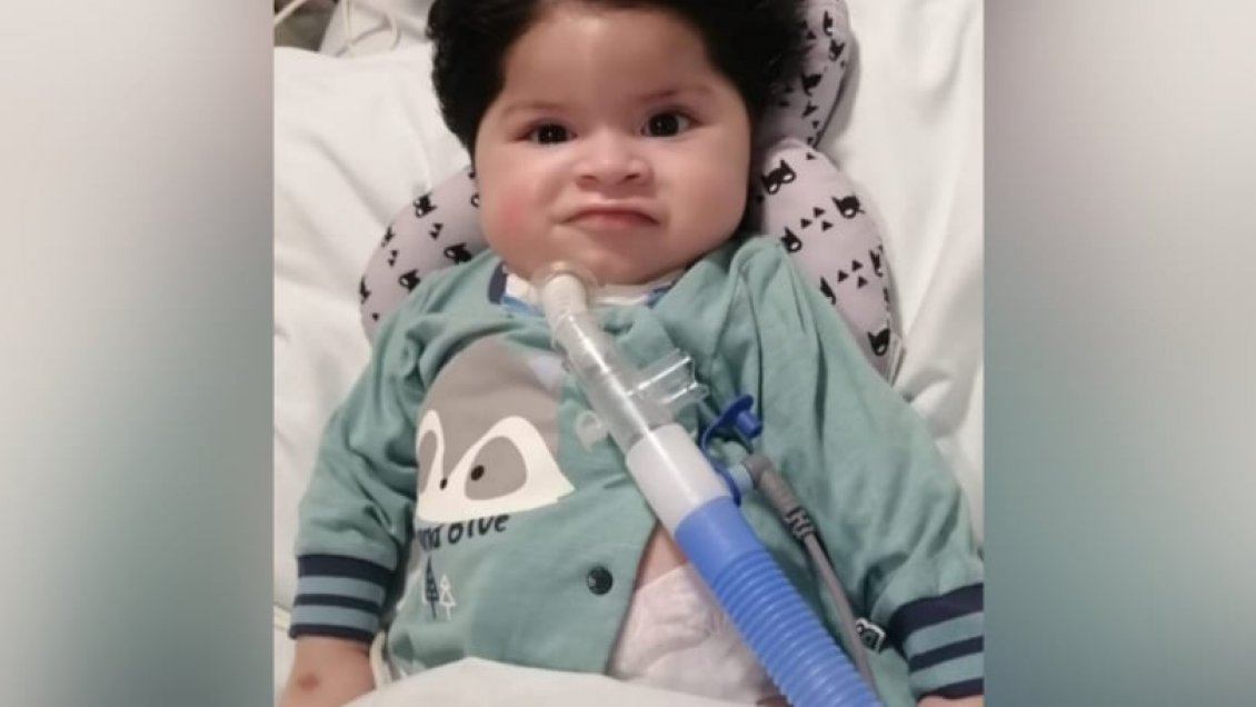 Minsal suspendió tratamiento de menor con atrofia muscular: Argumentan alto costo del tratamiento