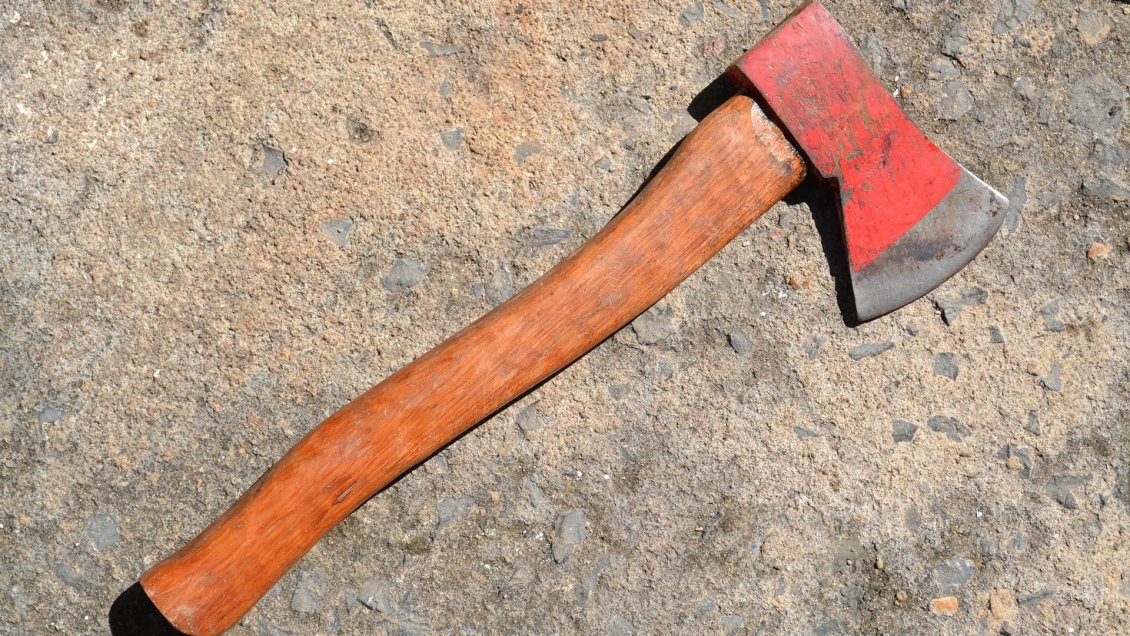 Lo Barnechea: Trabajador de servicentro fue atacado con un hacha y perdió dos dedos