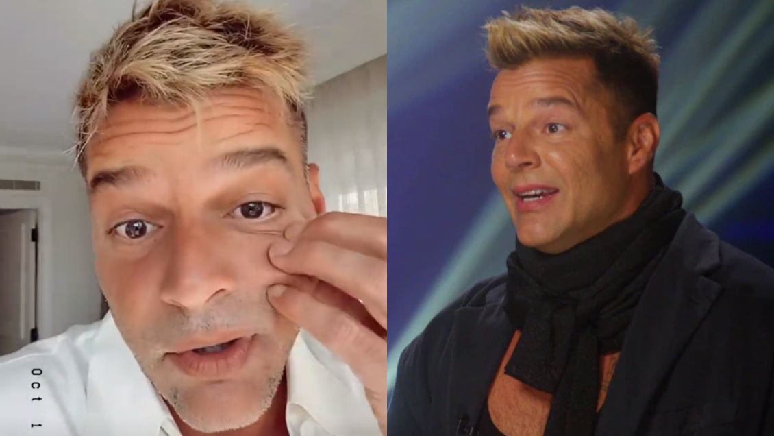 Ricky Martin sale a explicar su comentado cambio de rostro