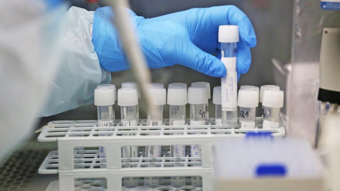 Científicos descubrieron método para evitar la infección por coronavirus