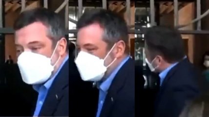   Sichel se pegó en la cabeza frente a las cámaras, pero reaccionó con humor 