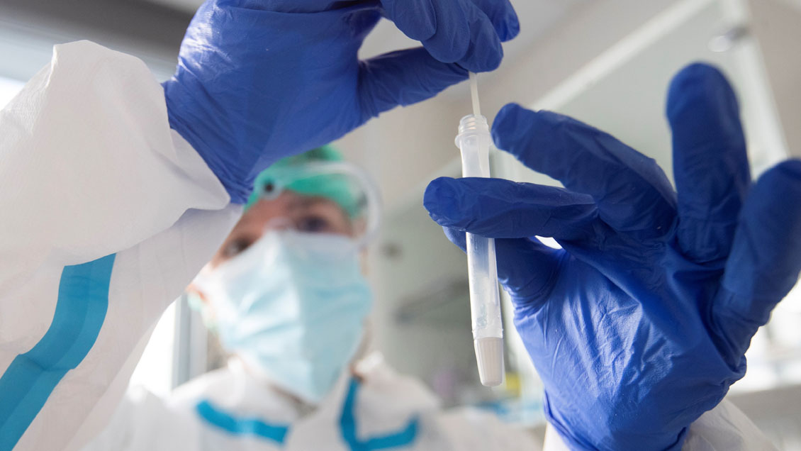 Brasil informó sus primeros casos de la variante Ómicron