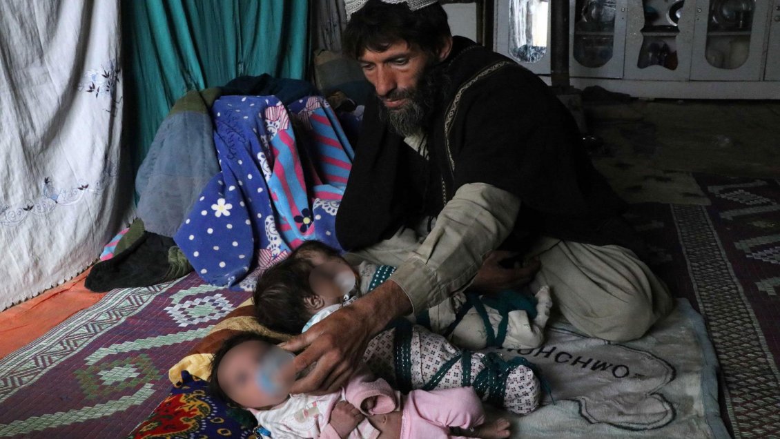 Unicef: La mitad de los menores de cinco años en Afganistán estará gravemente desnutridos en 2022