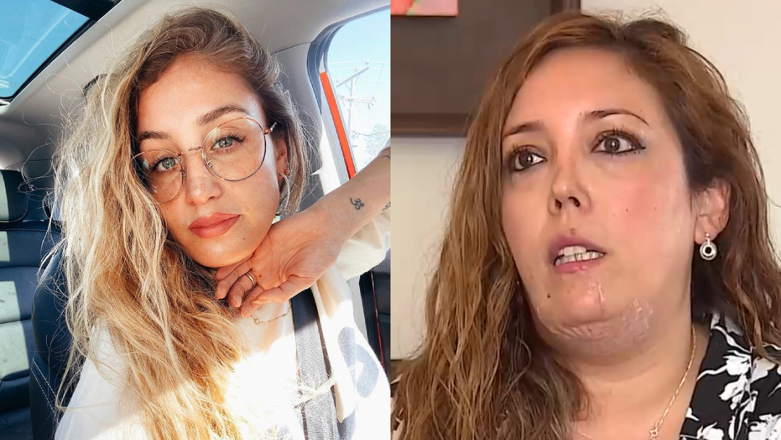 Daniela Castro responde a acusación de mujer que fue mordida por su perro