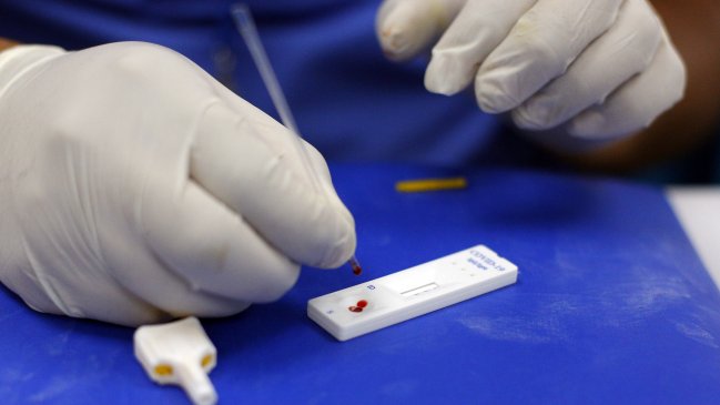 Químicos Farmacéuticos: El test de antígeno es una alerta; la confirmación debe realizarse con PCR