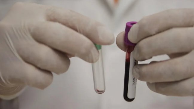 Científicos anuncian prometedores resultados en un tratamiento eficaz contra la leucemia