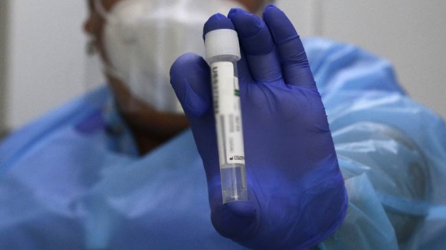 Hospital de Linares aisló a paciente con caso sospechoso de viruela del mono