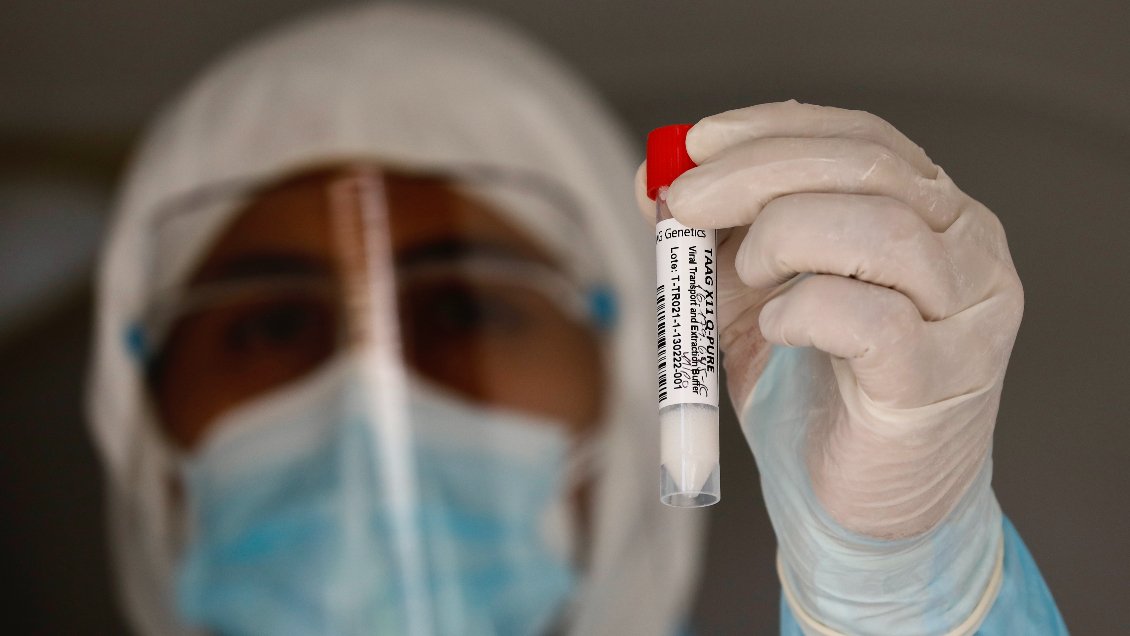 Reporte Covid: 13 regiones disminuyeron sus casos en la última semana